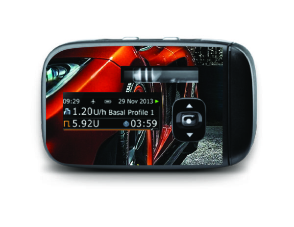 Pumpa Insight - Auto sport 2