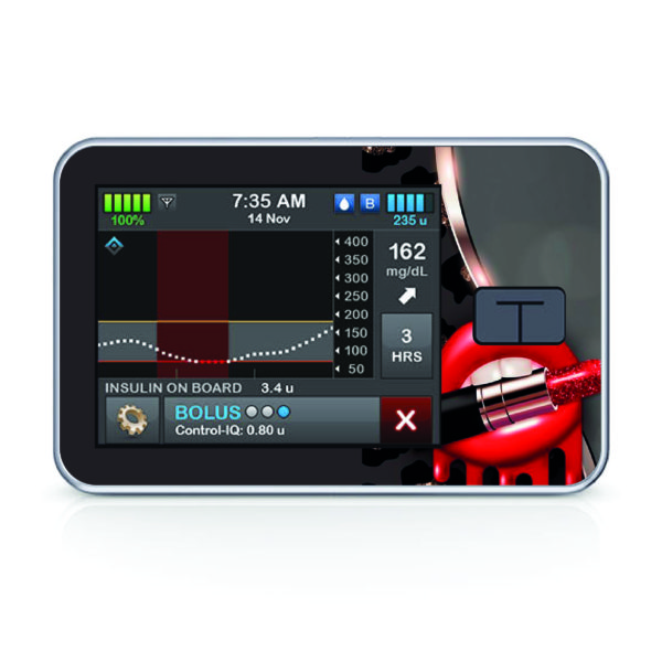 Tandem pumpa t:slim X2 - 31 - Lips