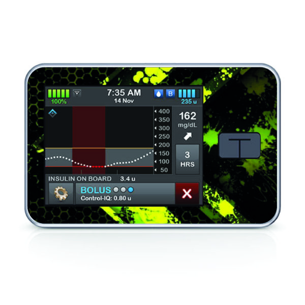 Tandem pumpa t:slim X2 - 47 - Boys 2