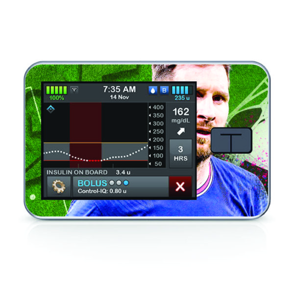 Tandem pumpa t:slim X2 - 86 - Messi