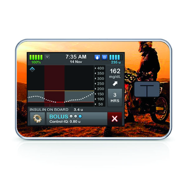 Tandem pumpa t:slim X2 - 102 - Cross