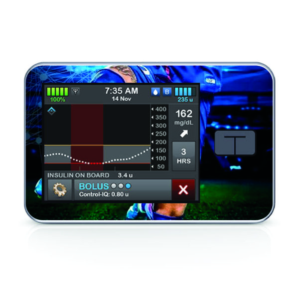 Tandem pumpa t:slim X2 - 87 - Fotbal 3