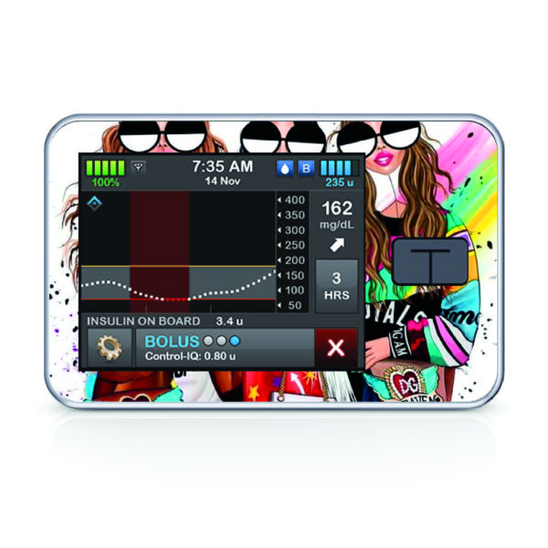Tandem pumpa t:slim X2 - 92 - Lady 2