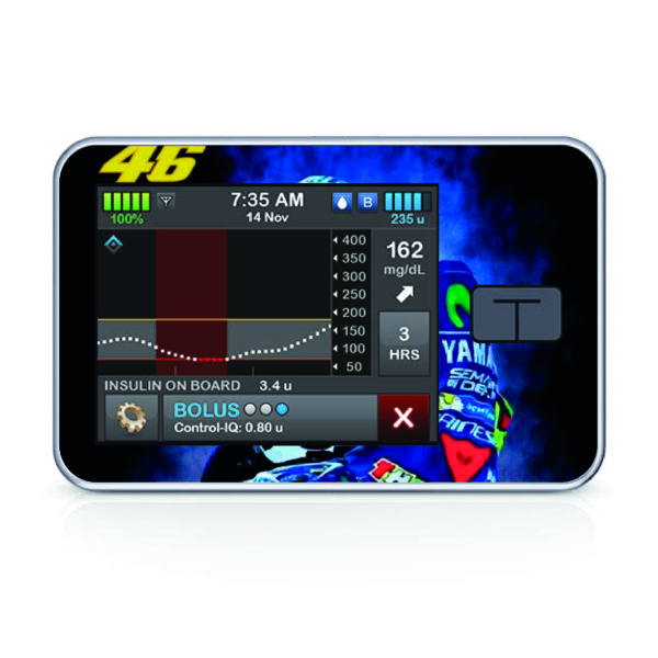 Tandem pumpa t:slim X2 - 106 - Moto 3