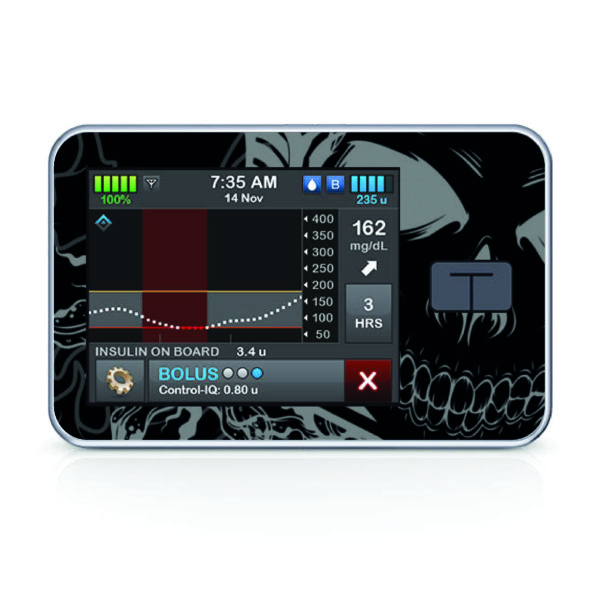Tandem pumpa t:slim X2 - 94 - Skull 2