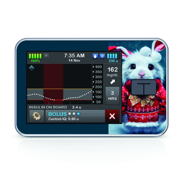 Tandem pumpa t:slim X2 - 114 - Zajda